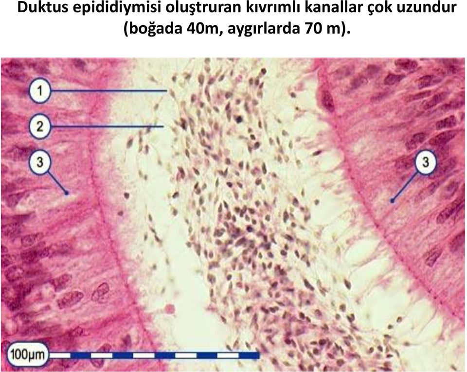 kanallar çok uzundur