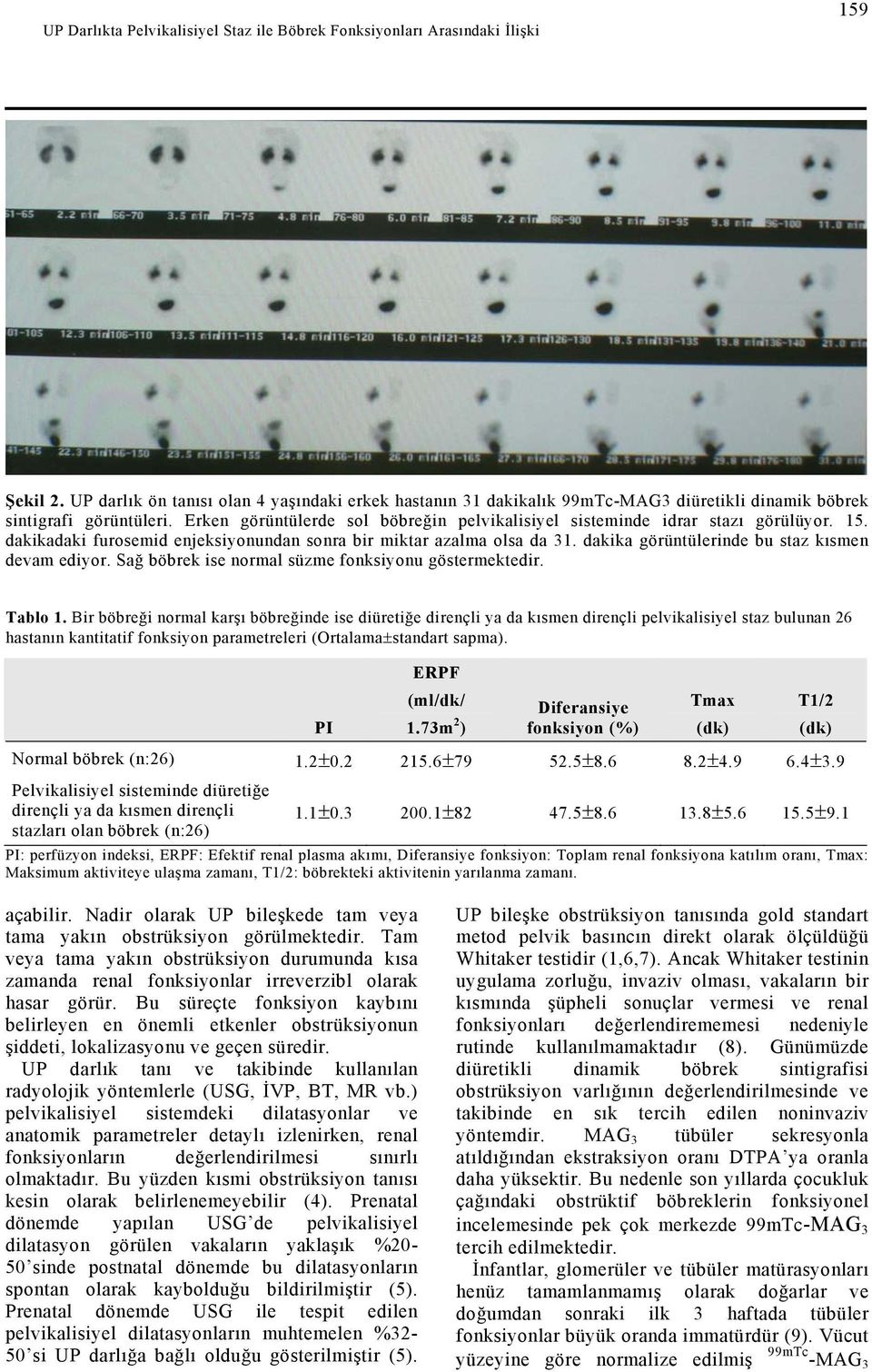 Erken görüntülerde sol böbreğin pelvikalisiyel sisteminde idrar stazı görülüyor. 15. dakikadaki furosemid enjeksiyonundan sonra bir miktar azalma olsa da 31.