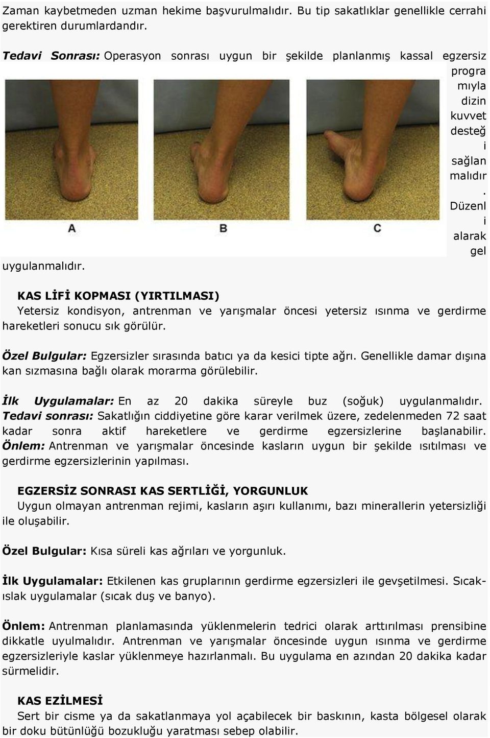 KAS LİFİ KOPMASI (YIRTILMASI) Yetersiz kondisyon, antrenman ve yarışmalar öncesi yetersiz ısınma ve gerdirme hareketleri sonucu sık görülür.