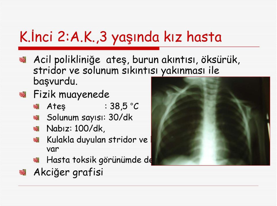 Fizik muayenede Ateş : 38,5 C Solunum sayısı: 30/dk Nabız: 100/dk, Kulakla