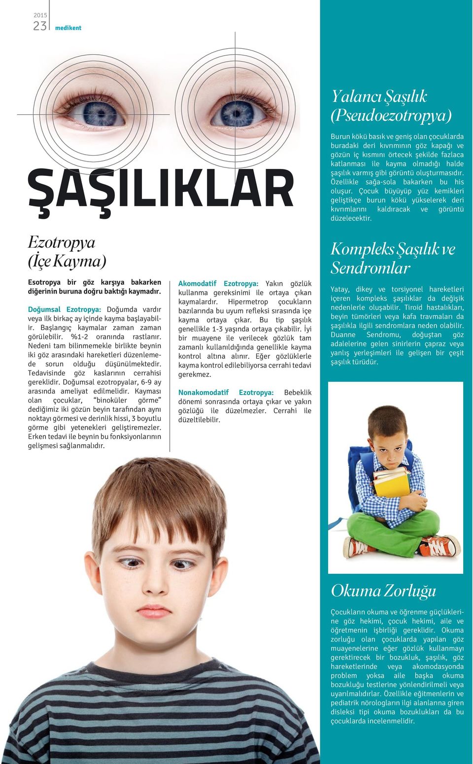 Nedeni tam bilinmemekle birlikte beynin iki göz arasındaki hareketleri düzenlemede sorun olduğu düşünülmektedir. Tedavisinde göz kaslarının cerrahisi gereklidir.