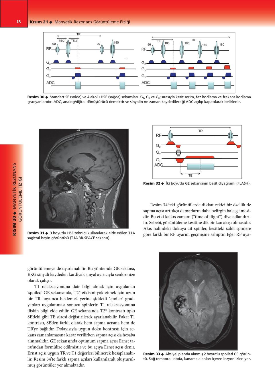 Resim 31 u 3 boyutlu HSE tekniği kullanılarak elde edilen T1A sagittal beyin görüntüsü (T1A 3B-SPACE sekansı). Resim 32 u İki boyutlu GE sekansının basit diyagramı (FLASH).