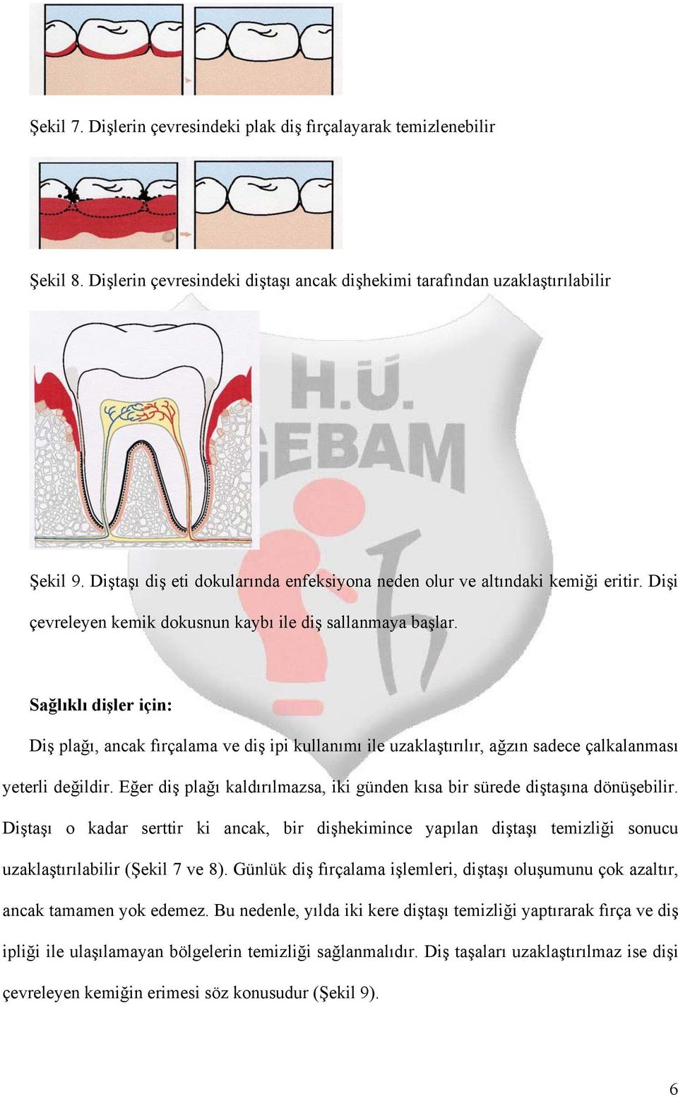 Sağlıklı dişler için: Diş plağı, ancak fırçalama ve diş ipi kullanımı ile uzaklaştırılır, ağzın sadece çalkalanması yeterli değildir.