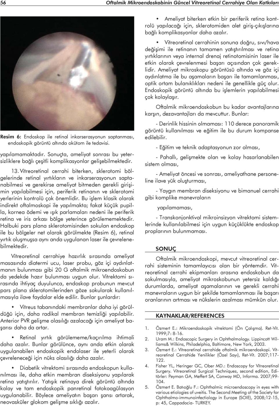 Vitreoretinal cerrahi biterken, sklerotomi bölgelerinde retinal yırtıkların ve inkarserasyonun saptanabilmesi ve gerekirse ameliyat bitmeden gerekli girişimin yapılabilmesi için, periferik retinanın