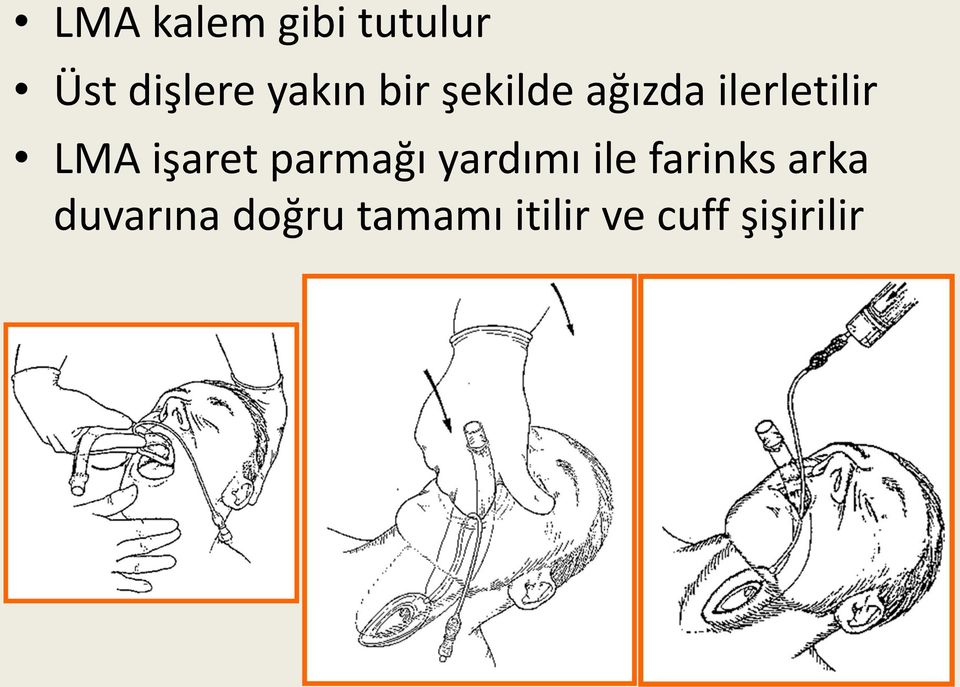 işaret parmağı yardımı ile farinks arka