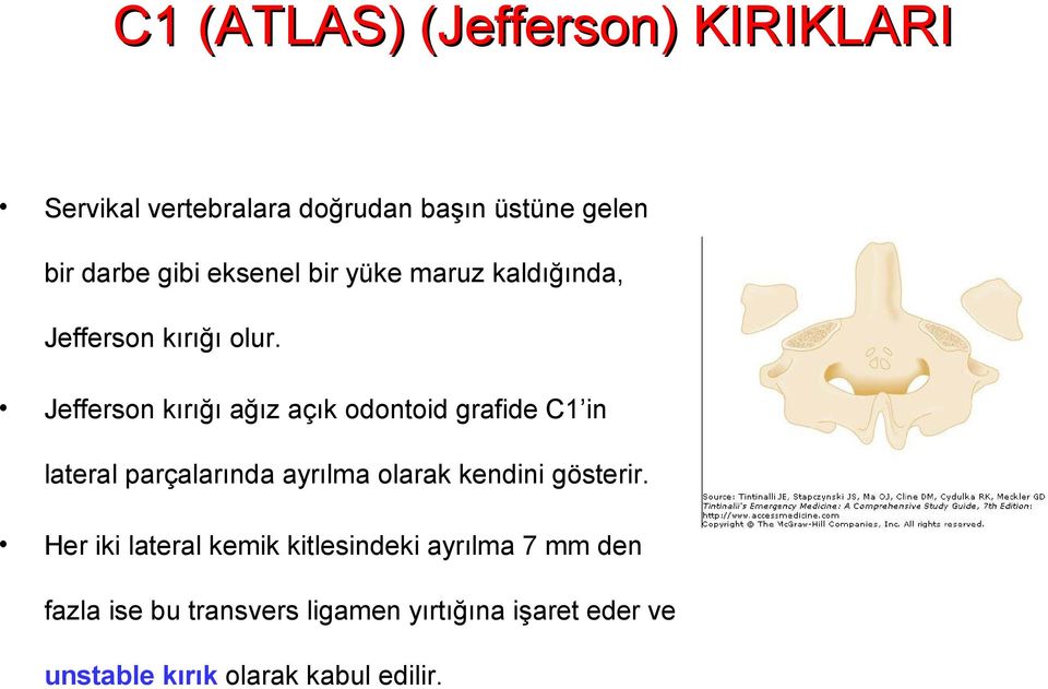 Jefferson kırığı ağız açık odontoid grafide C1 in lateral parçalarında ayrılma olarak kendini