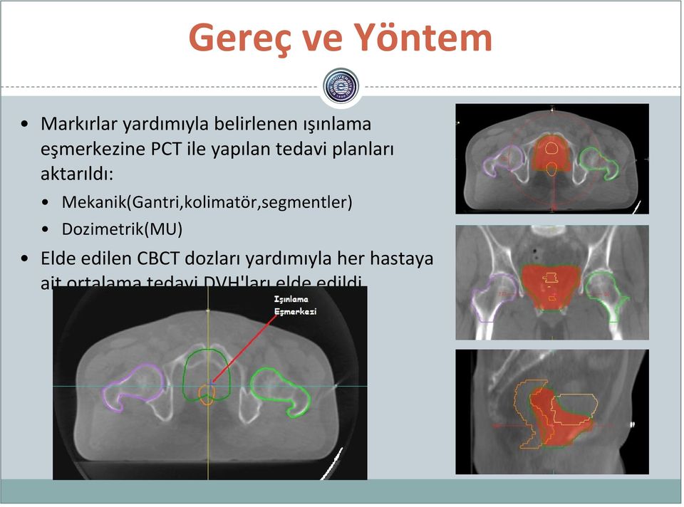 Mekanik(Gantri,kolimatör,segmentler) Dozimetrik(MU) Elde edilen