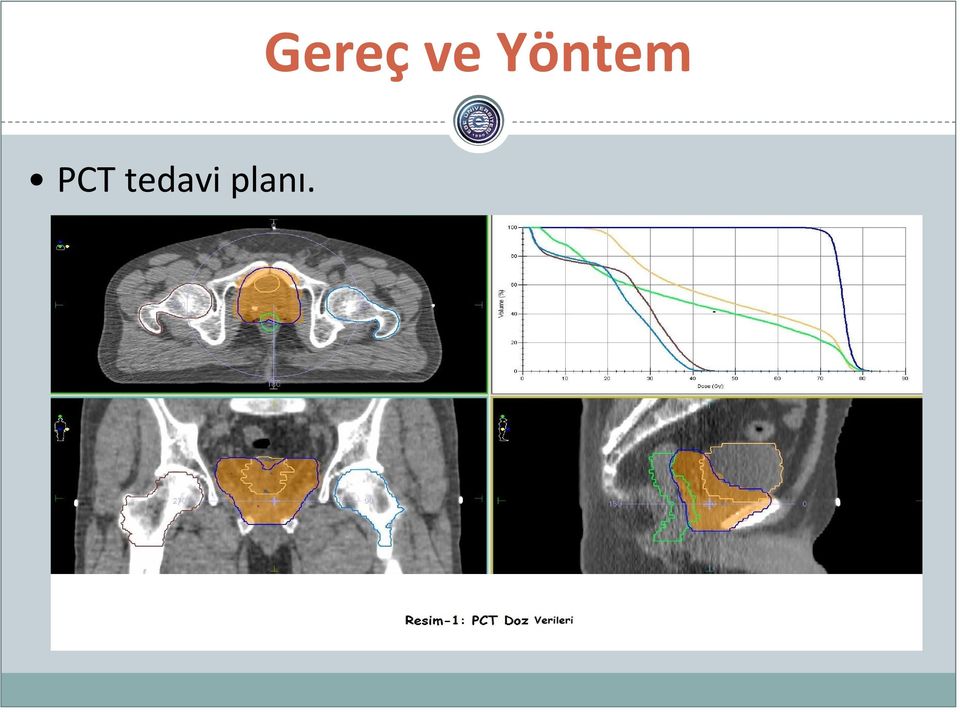 planı.