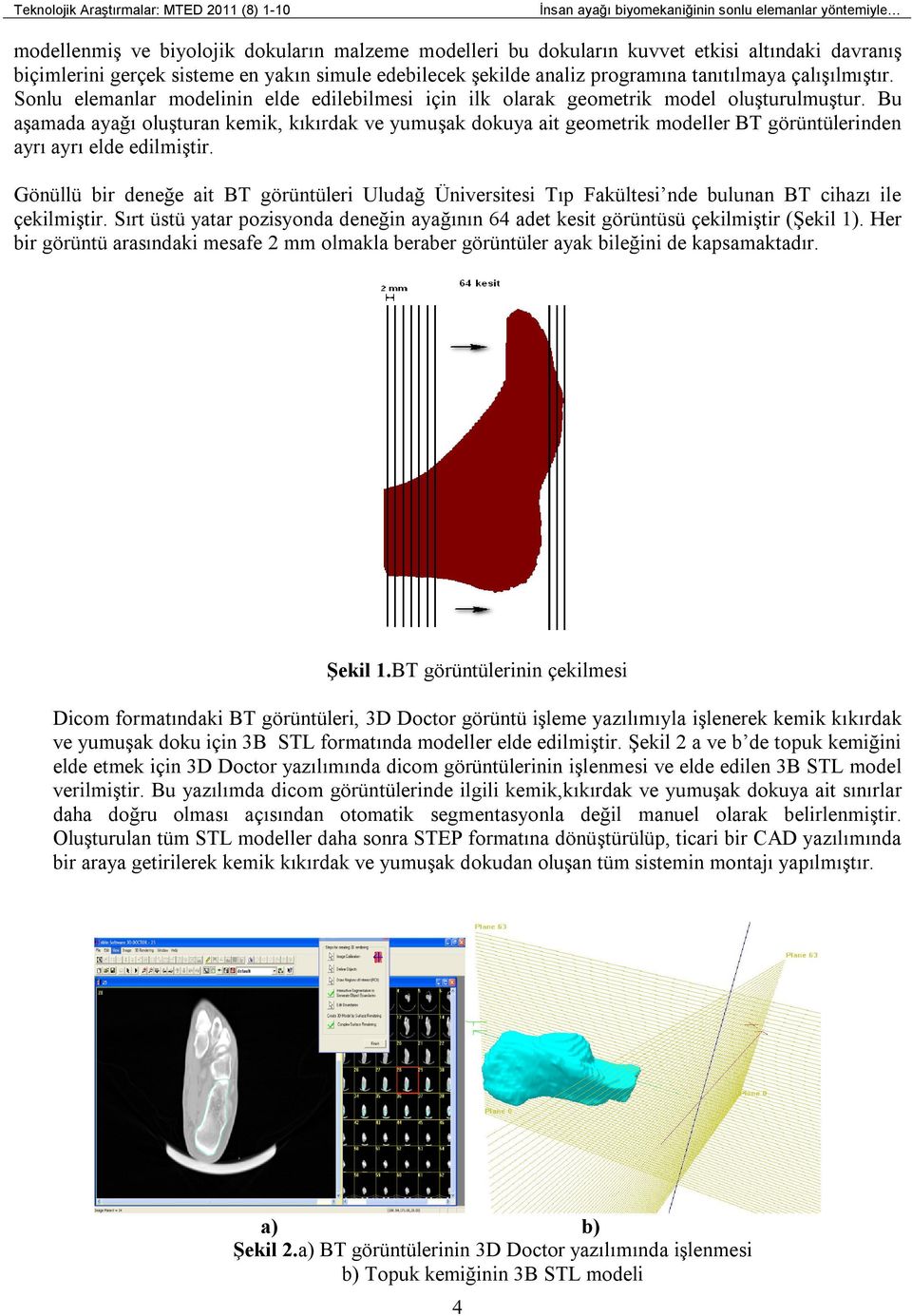 Bu aşamada ayağı oluşturan kemik, kıkırdak ve yumuşak dokuya ait geometrik modeller BT görüntülerinden ayrı ayrı elde edilmiştir.