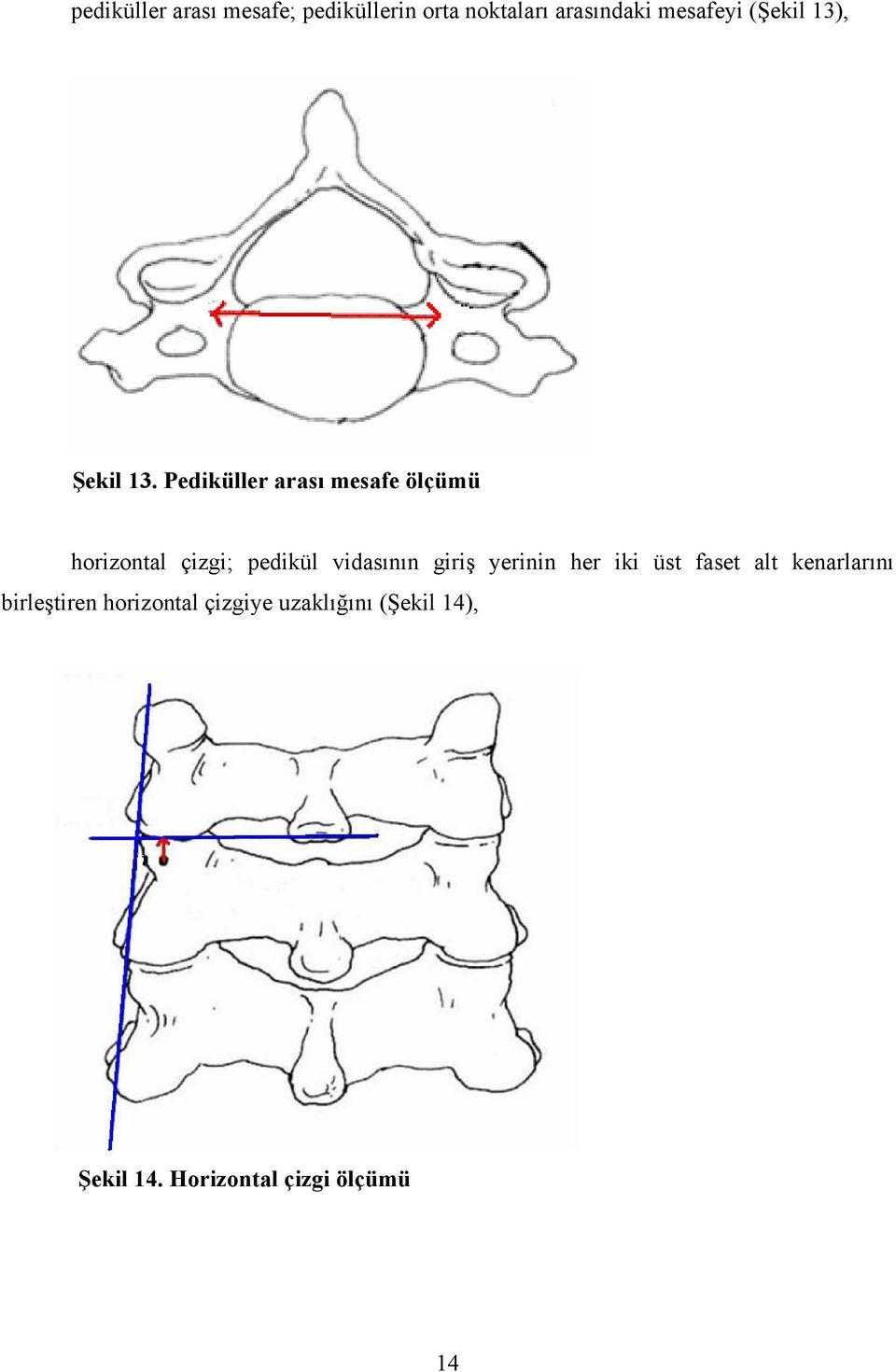 Pediküller arası mesafe ölçümü horizontal çizgi; pedikül vidasının giriş