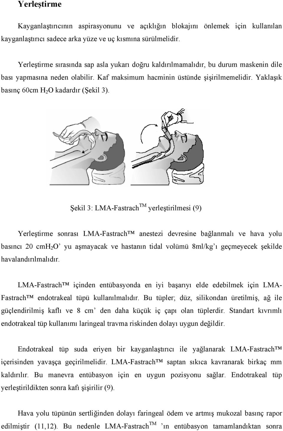 Yaklaşık basınç 60cm H 2 O kadardır (Şekil 3).