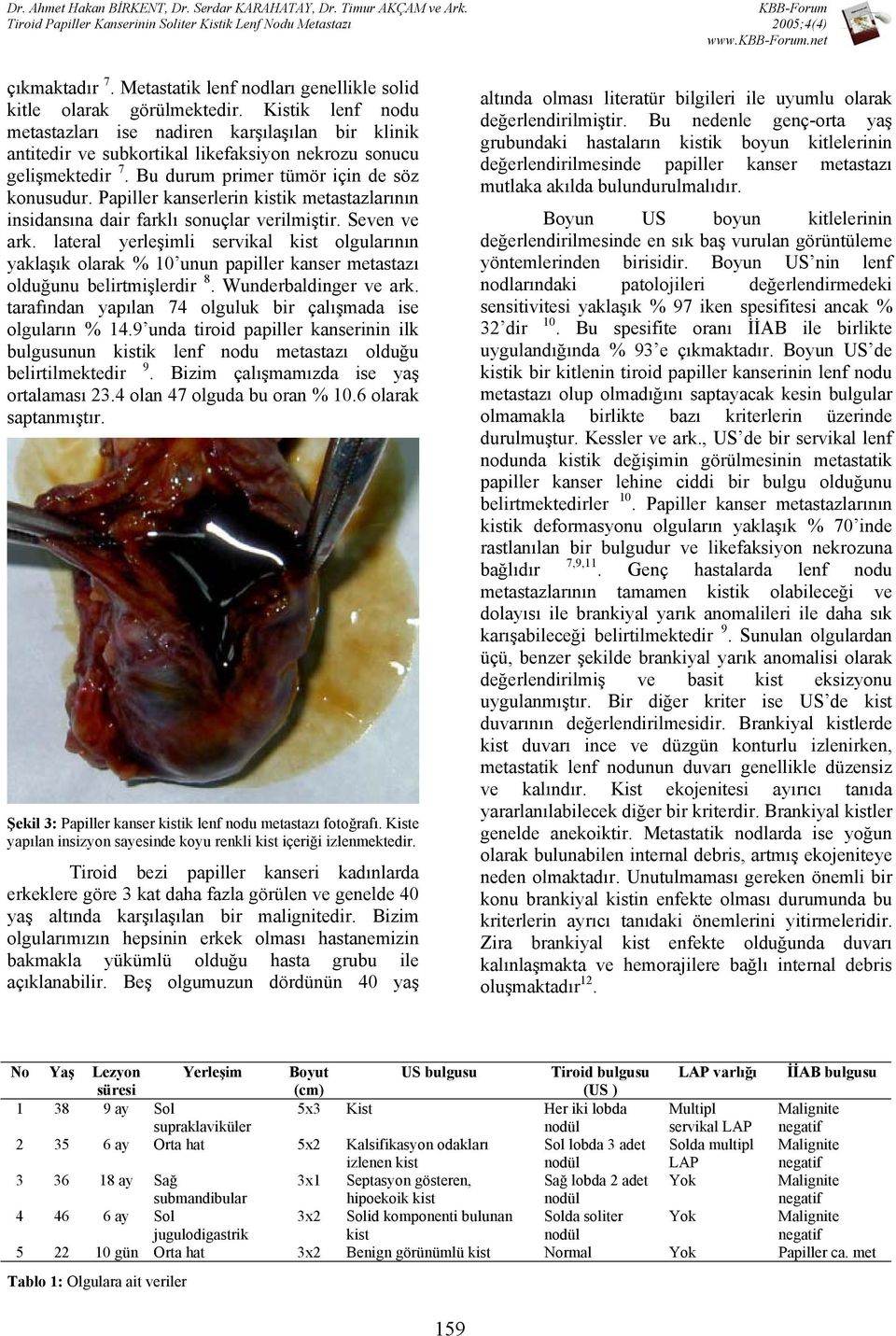 Papiller kanserlerin kistik metastazlarının insidansına dair farklı sonuçlar verilmiştir. Seven ve ark.