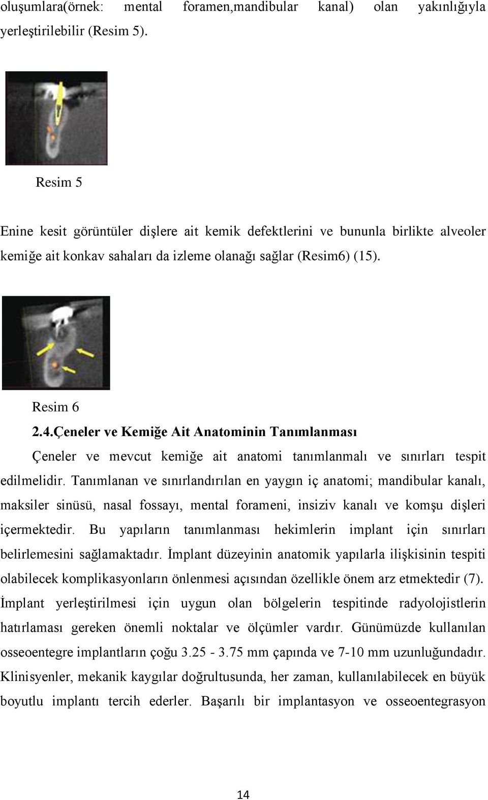 Çeneler ve Kemiğe Ait Anatominin Tanımlanması Çeneler ve mevcut kemiğe ait anatomi tanımlanmalı ve sınırları tespit edilmelidir.