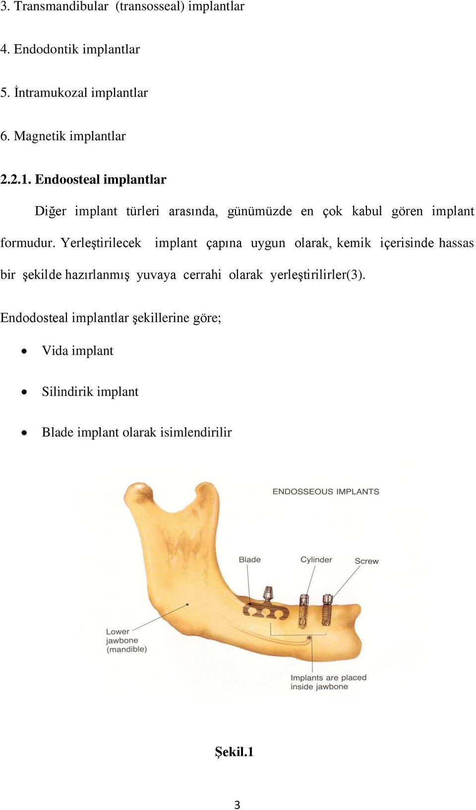 Yerleştirilecek implant çapına uygun olarak, kemik içerisinde hassas bir şekilde hazırlanmış yuvaya cerrahi olarak