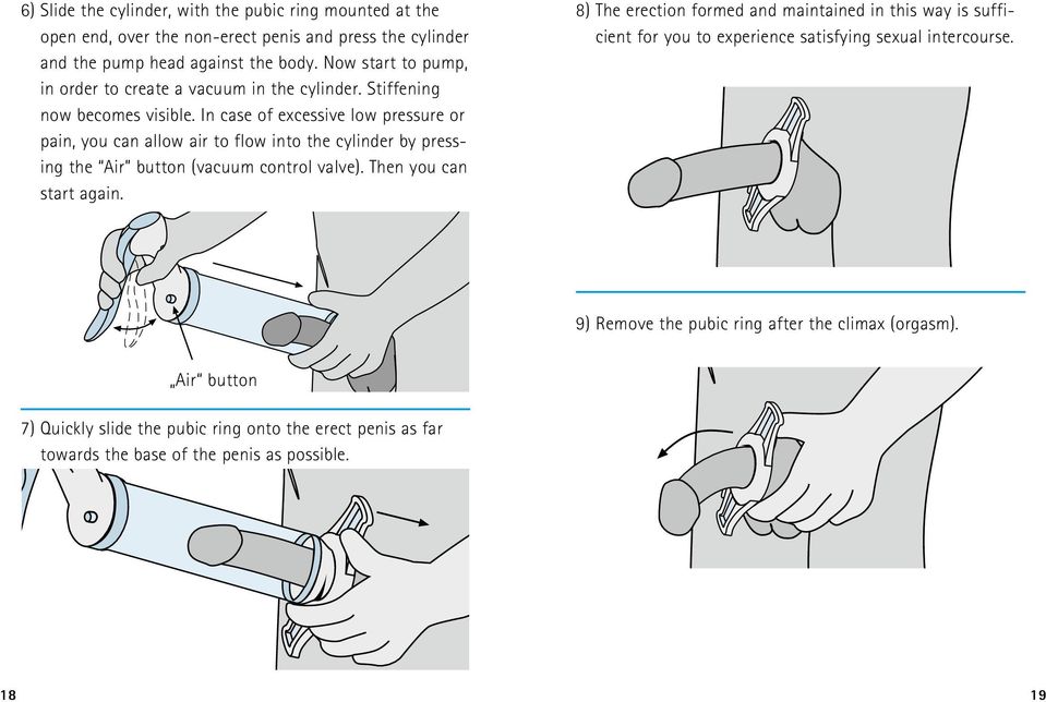 In case of excessive low pressure or pain, you can allow air to flow into the cylinder by pressing the Air button (vacuum control valve). Then you can start again.