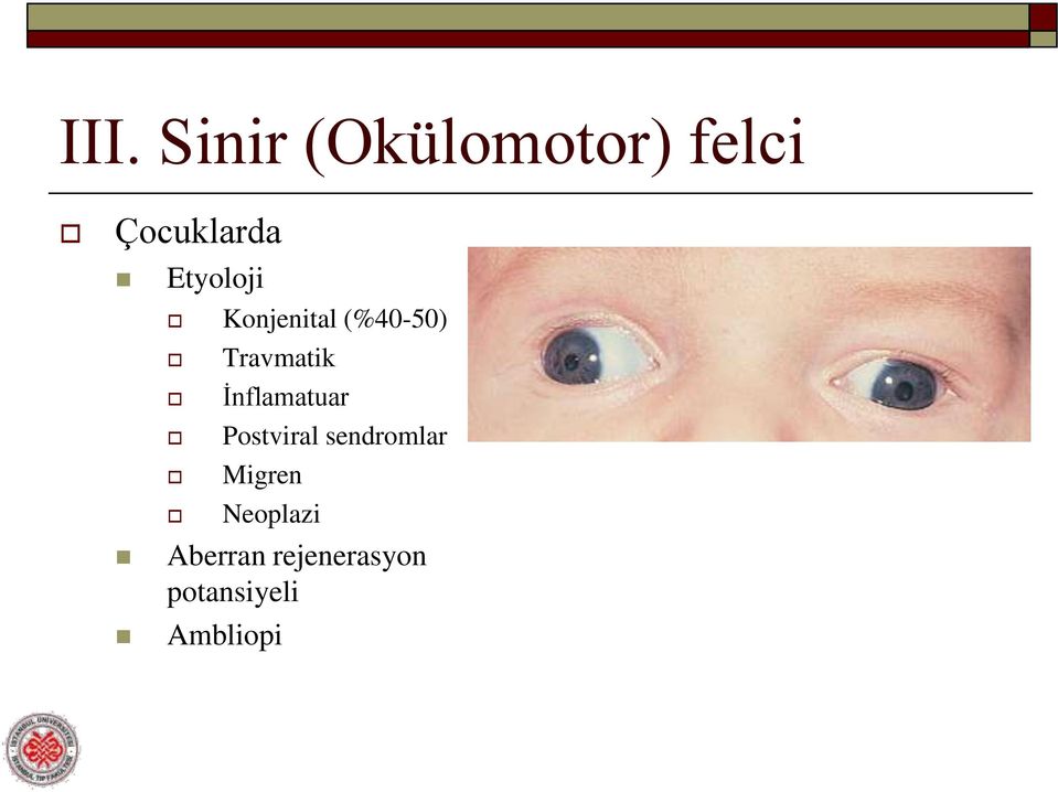 İnflamatuar Postviral sendromlar Migren