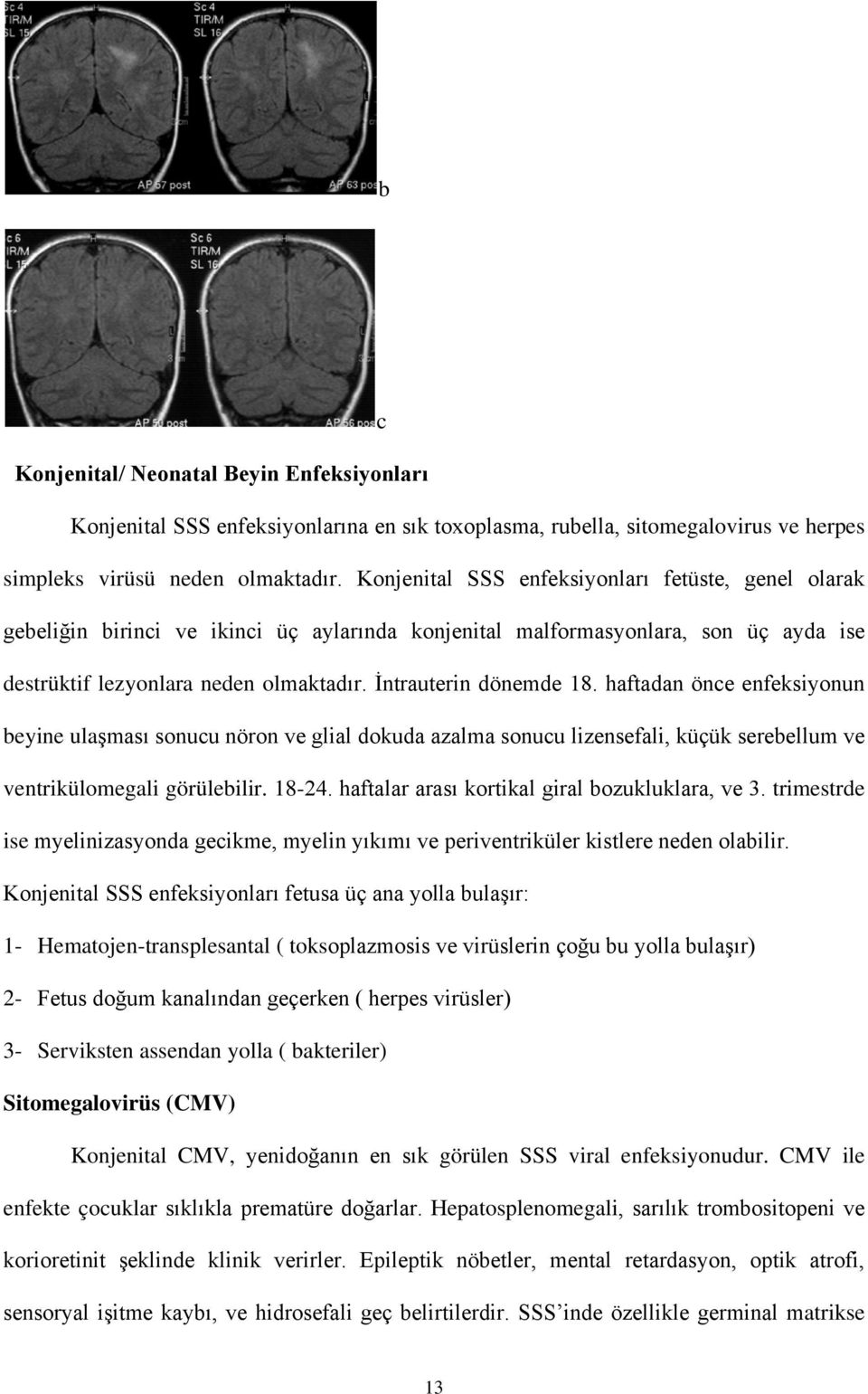 İntrauterin dönemde 18. haftadan önce enfeksiyonun beyine ulaşması sonucu nöron ve glial dokuda azalma sonucu lizensefali, küçük serebellum ve ventrikülomegali görülebilir. 18-24.