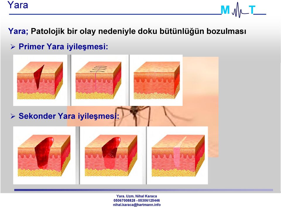 bir olay nedeniyle doku bütünlüğün