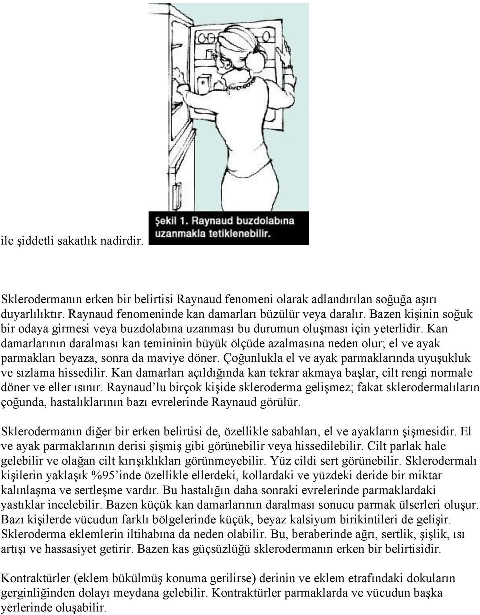 Kan damarlarının daralması kan temininin büyük ölçüde azalmasına neden olur; el ve ayak parmakları beyaza, sonra da maviye döner. Çoğunlukla el ve ayak parmaklarında uyuşukluk ve sızlama hissedilir.