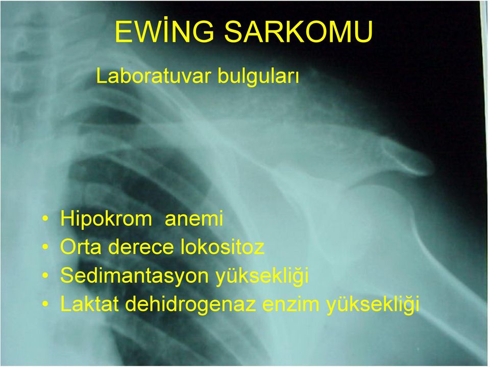 derece lokositoz Sedimantasyon