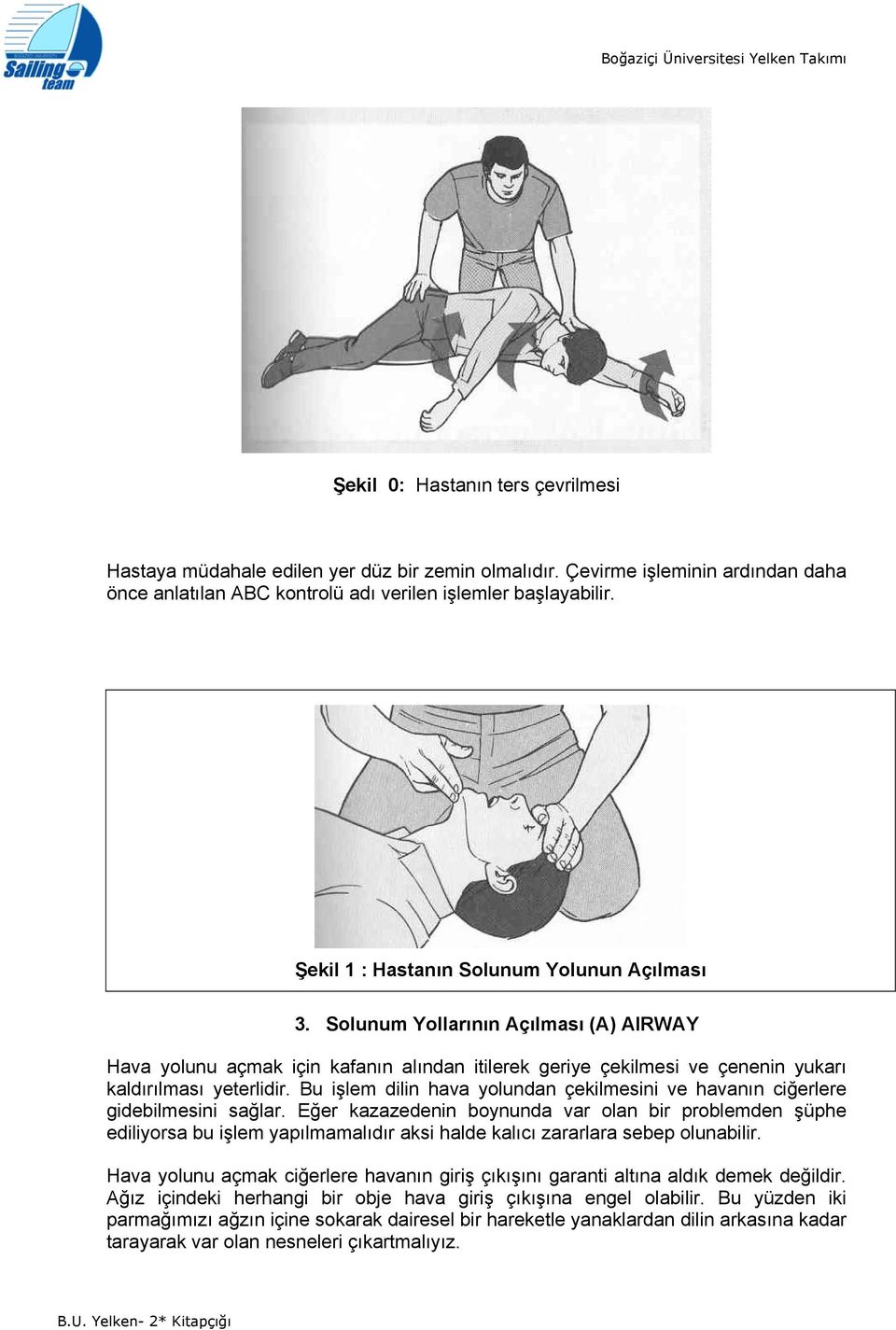 Slunum Yllarının Açılması (A) AIRWAY Hava ylunu açmak için kafanın alından itilerek geriye çekilmesi ve çenenin yukarı kaldırılması yeterlidir.