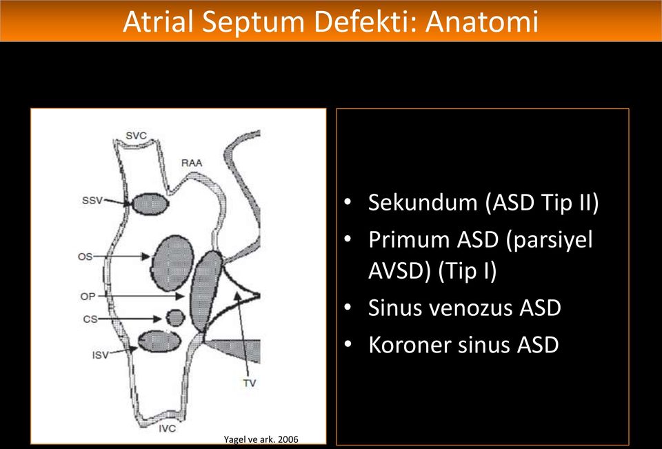 KKH %8-9 Sekundum (ASD Tip II) Primum ASD (parsiyel