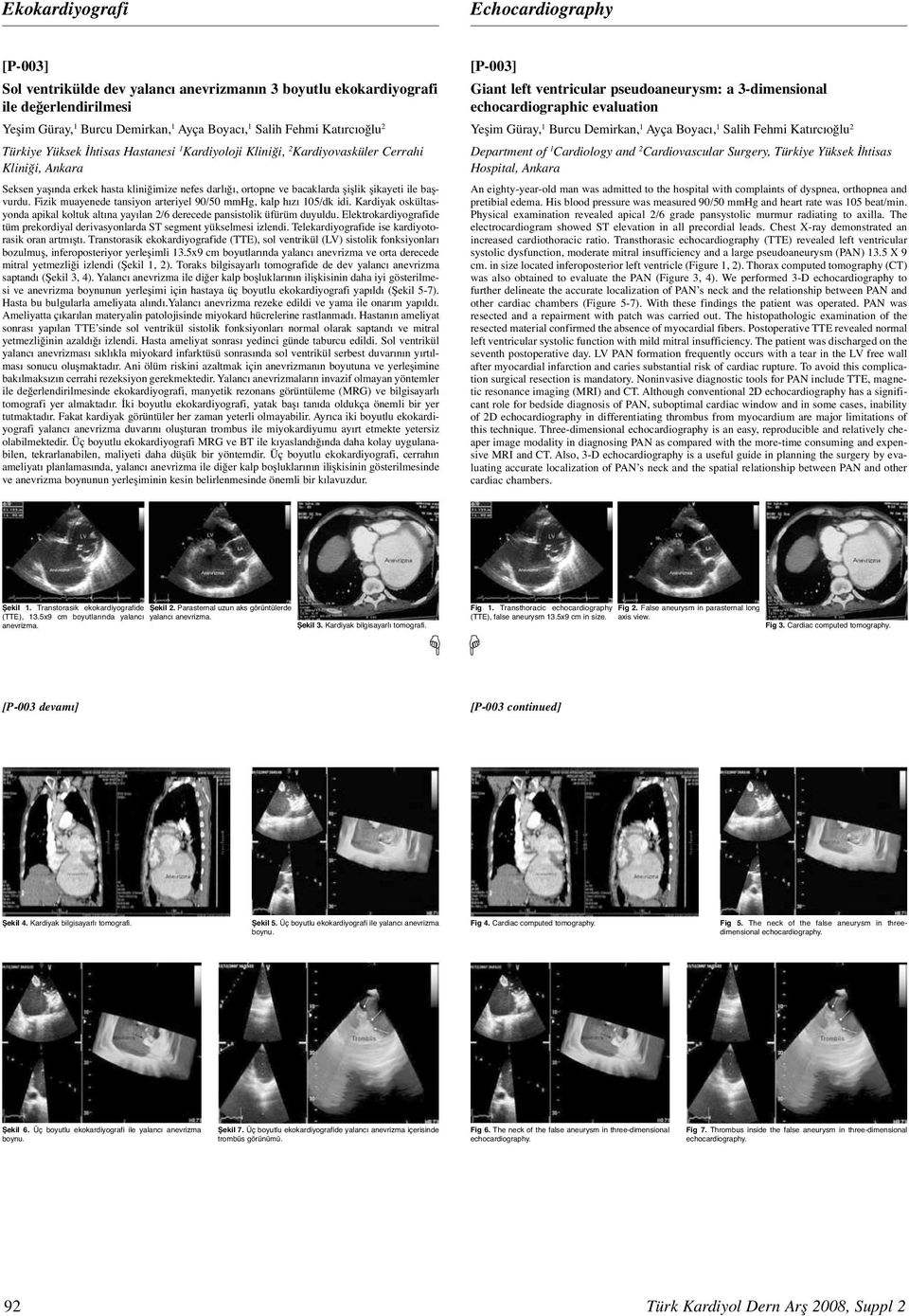 başvurdu. Fizik muayenede tansiyon arteriyel 90/50 mmhg, kalp hızı 05/dk idi. Kardiyak oskültasyonda apikal koltuk altına yayılan 2/6 derecede pansistolik üfürüm duyuldu.