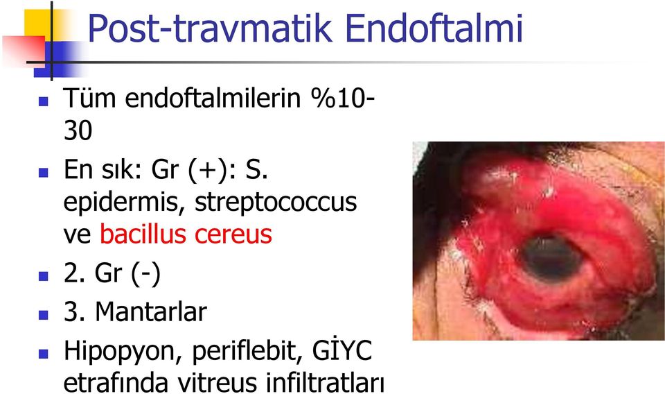 epidermis, streptococcus ve bacillus cereus 2.