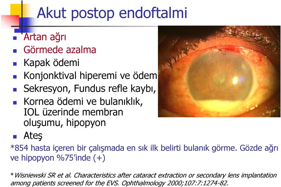 sık ilk belirti bulanık görme. Gözde ağrı ve hipopyon %75 inde (+) *Wisniewski SR et al.