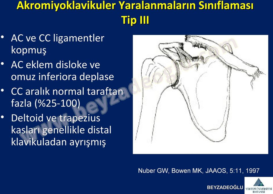 aralık normal taraftan fazla (%25-100) Deltoid ve trapezius kasları