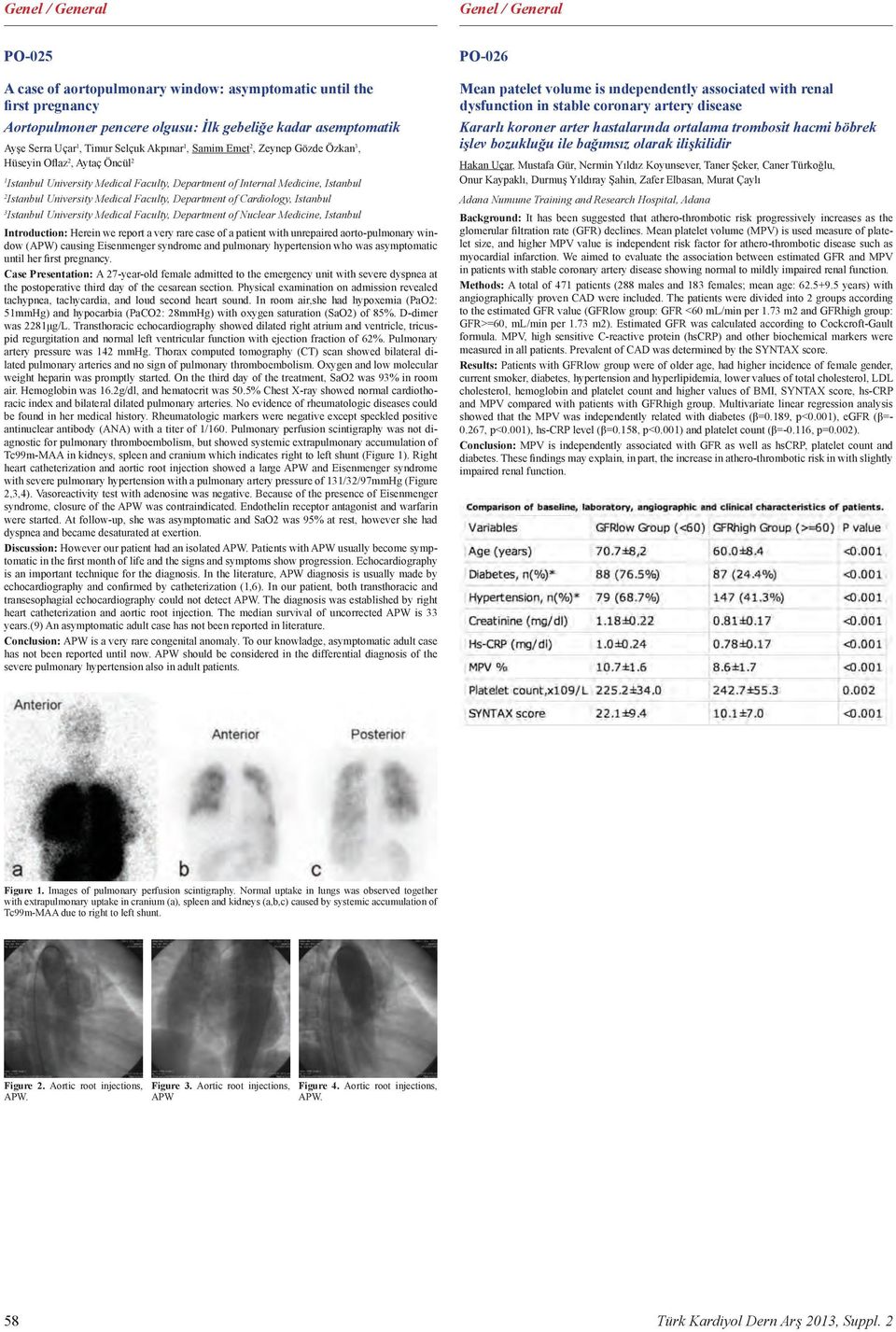 Department of Cardiology, Istanbul 3 Istanbul University Medical Faculty, Department of Nuclear Medicine, Istanbul Introduction: Herein we report a very rare case of a patient with unrepaired