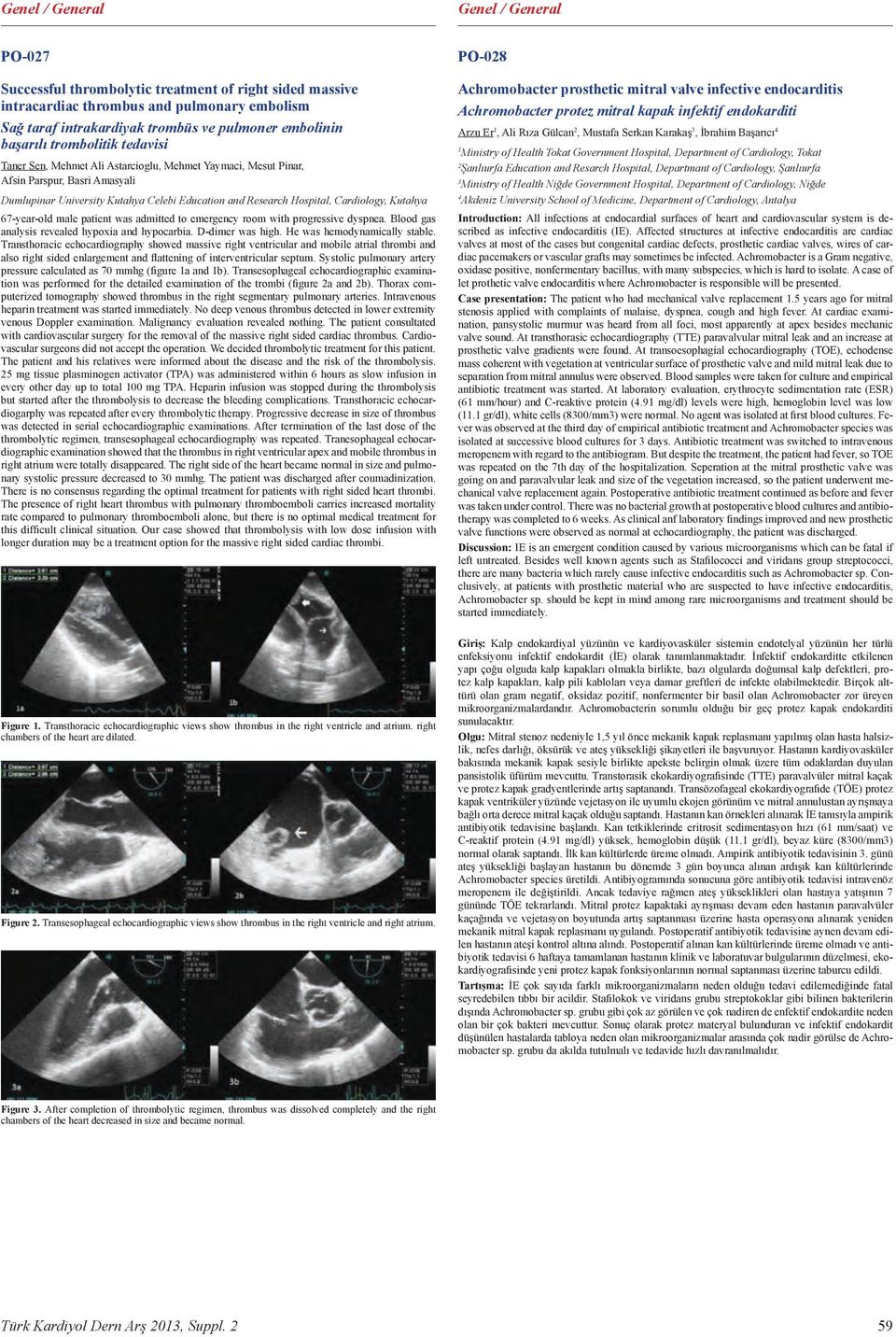 Cardiology, Kutahya 67-year-old male patient was admitted to emergency room with progressive dyspnea. Blood gas analysis revealed hypoxia and hypocarbia. D-dimer was high.