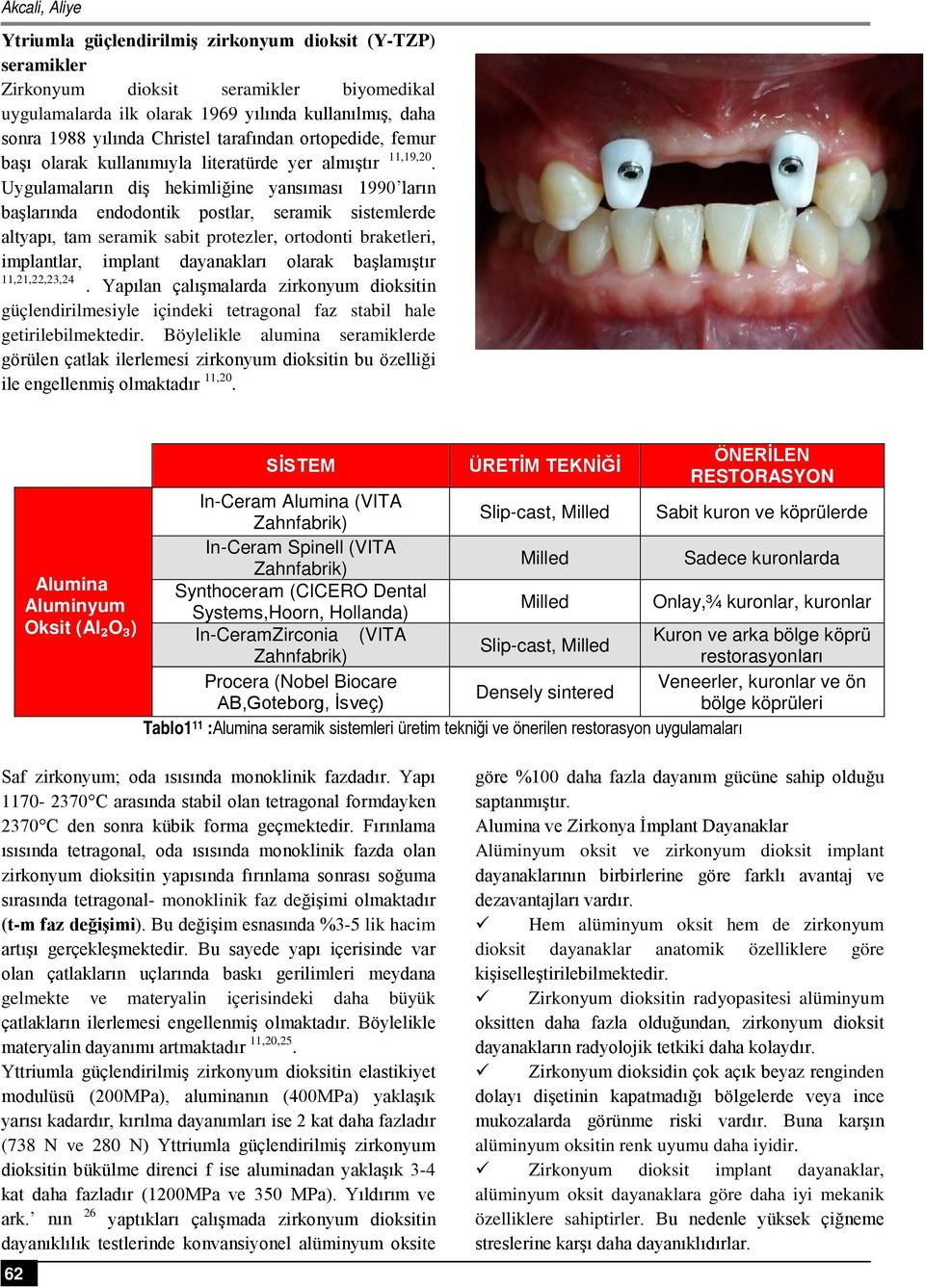 Uygulamaların diş hekimliğine yansıması 1990 ların başlarında endodontik postlar, seramik sistemlerde altyapı, tam seramik sabit protezler, ortodonti braketleri, implantlar, implant dayanakları