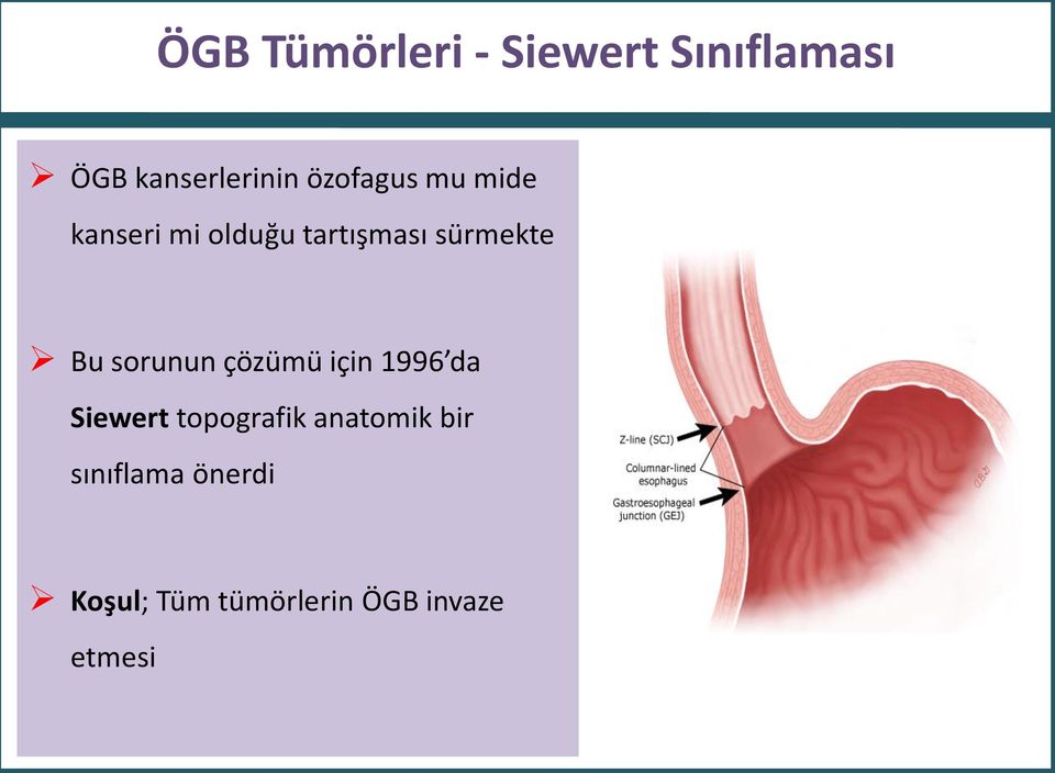 bir sınıflama önerdi Koşul; Tüm tümörlerin ÖGB invaze etmesi *J Surg Oncol