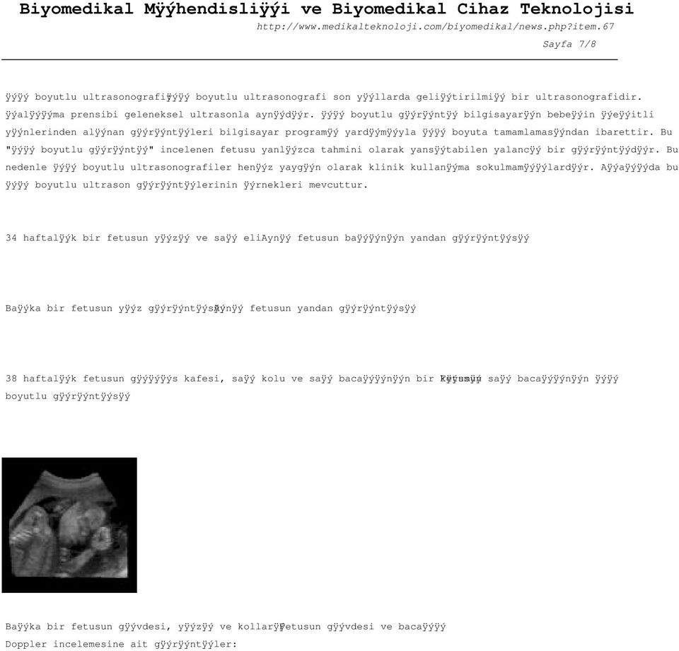 0 7 0 5 0 7 0 5 boyutlu g 0 7 0 5r 0 7 0 5nt 0 7 0 5 bilgisayar 0 7 0 5n bebe 0 7 0 5in 0 7 0 5e 0 7 0 5itli y 0 7 0 5nlerinden al 0 7 0 5nan g 0 7 0 5r 0 7 0 5nt 0 7 0 5leri bilgisayar program 0 7 0