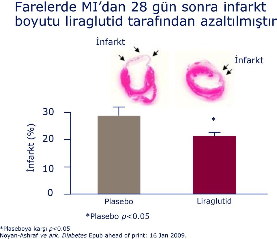 20 10 0 Plasebo *Plasebo p<0.05 Liraglutid *Plaseboya karşı p<0.