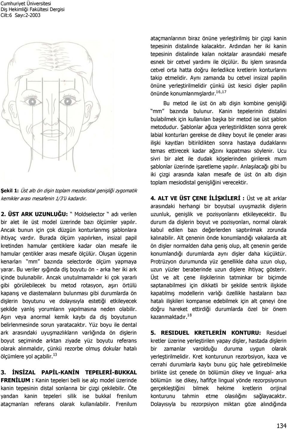 Burada ölçüm yapılırken, insizal papil kretinden hamular çentiklere kadar olan mesafe ile hamular çentikler arası mesafe ölçülür. Oluşan üçgenin kenarları mm bazında selectorde ölçüm yapmaya yarar.