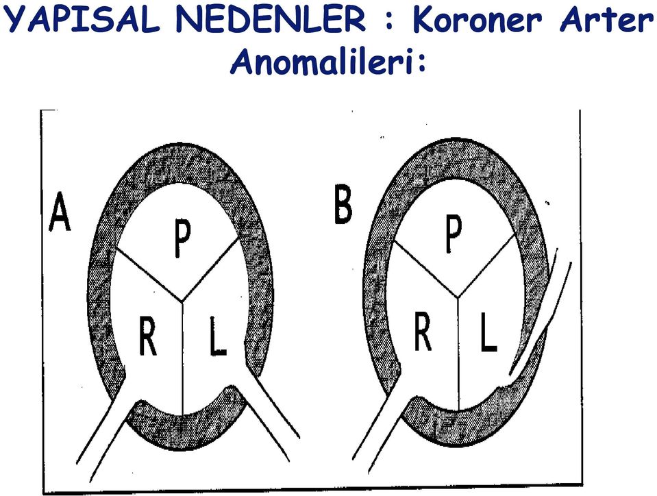 Koroner