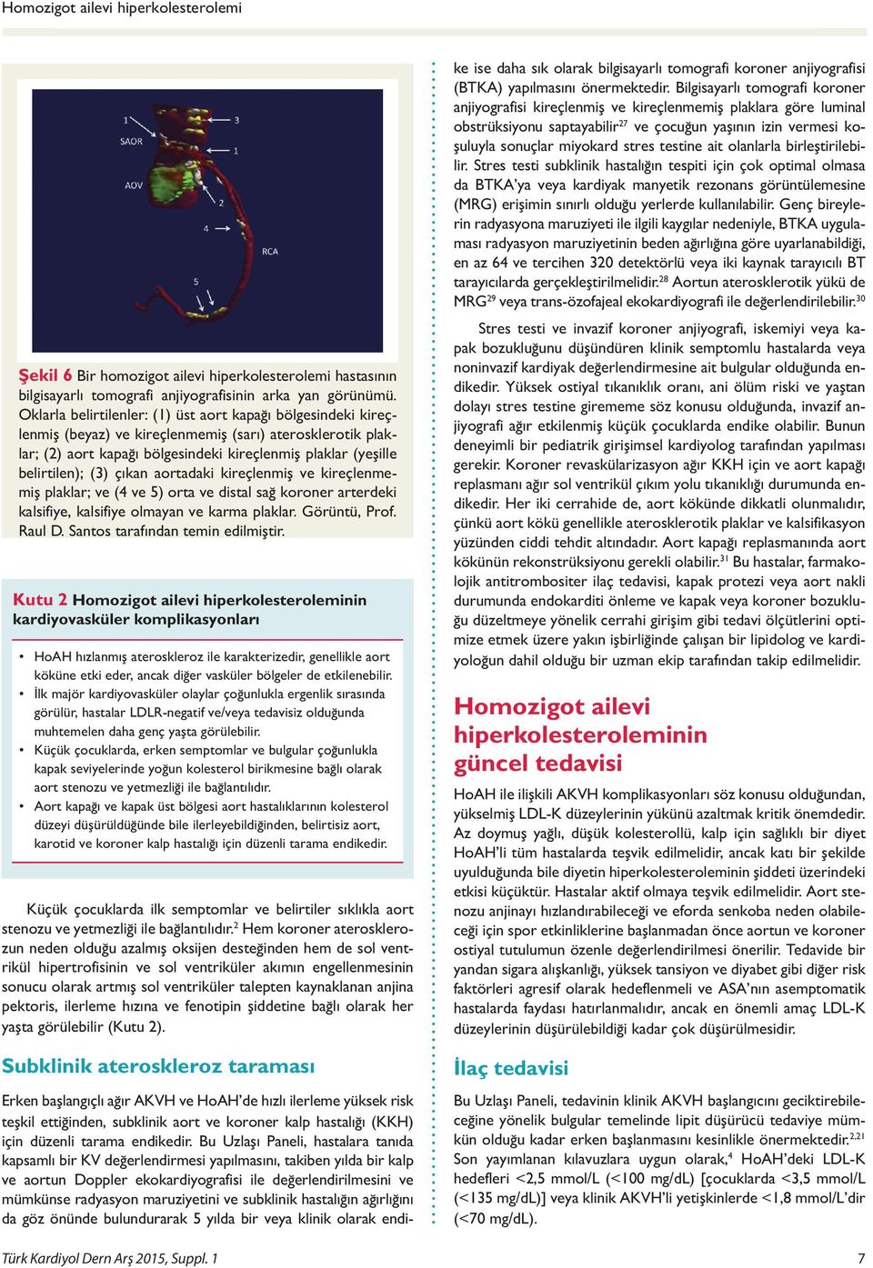 çıkan aortadaki kireçlenmiş ve kireçlenmemiş plaklar; ve (4 ve 5) orta ve distal sağ koroner arterdeki kalsifiye, kalsifiye olmayan ve karma plaklar. Görüntü, Prof. Raul D.