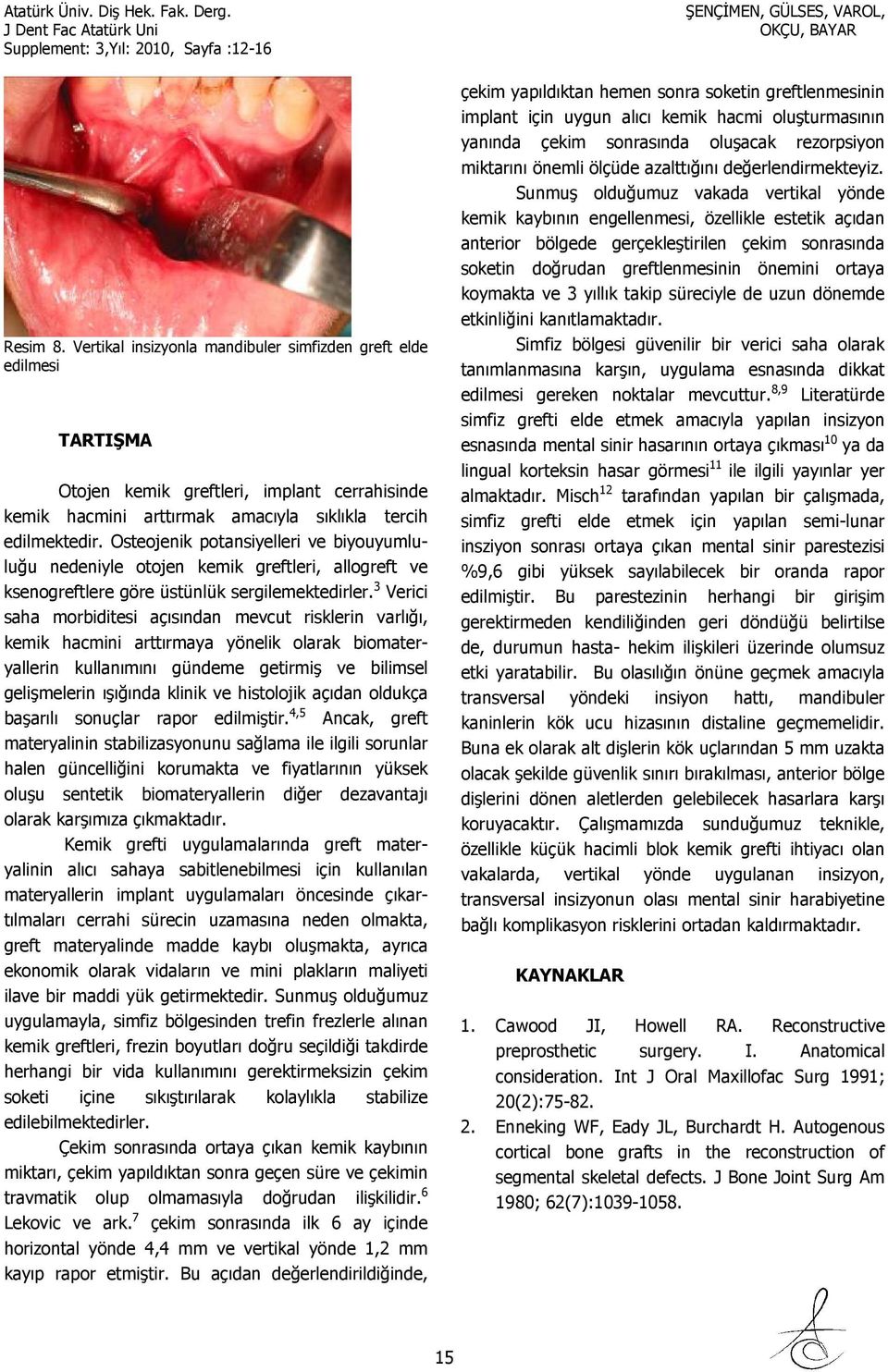 3 Verici saha morbiditesi açısından mevcut risklerin varlığı, kemik hacmini arttırmaya yönelik olarak biomateryallerin kullanımını gündeme getirmiş ve bilimsel gelişmelerin ışığında klinik ve