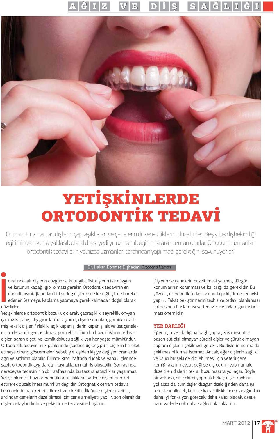 Ortodonti uzmanları ortodontik tedavilerin yalnızca uzmanları tarafından yapılması gerektiğini savunuyorlar! Dr.