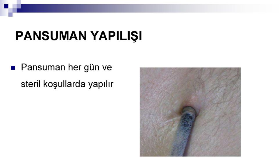 Pansuman her