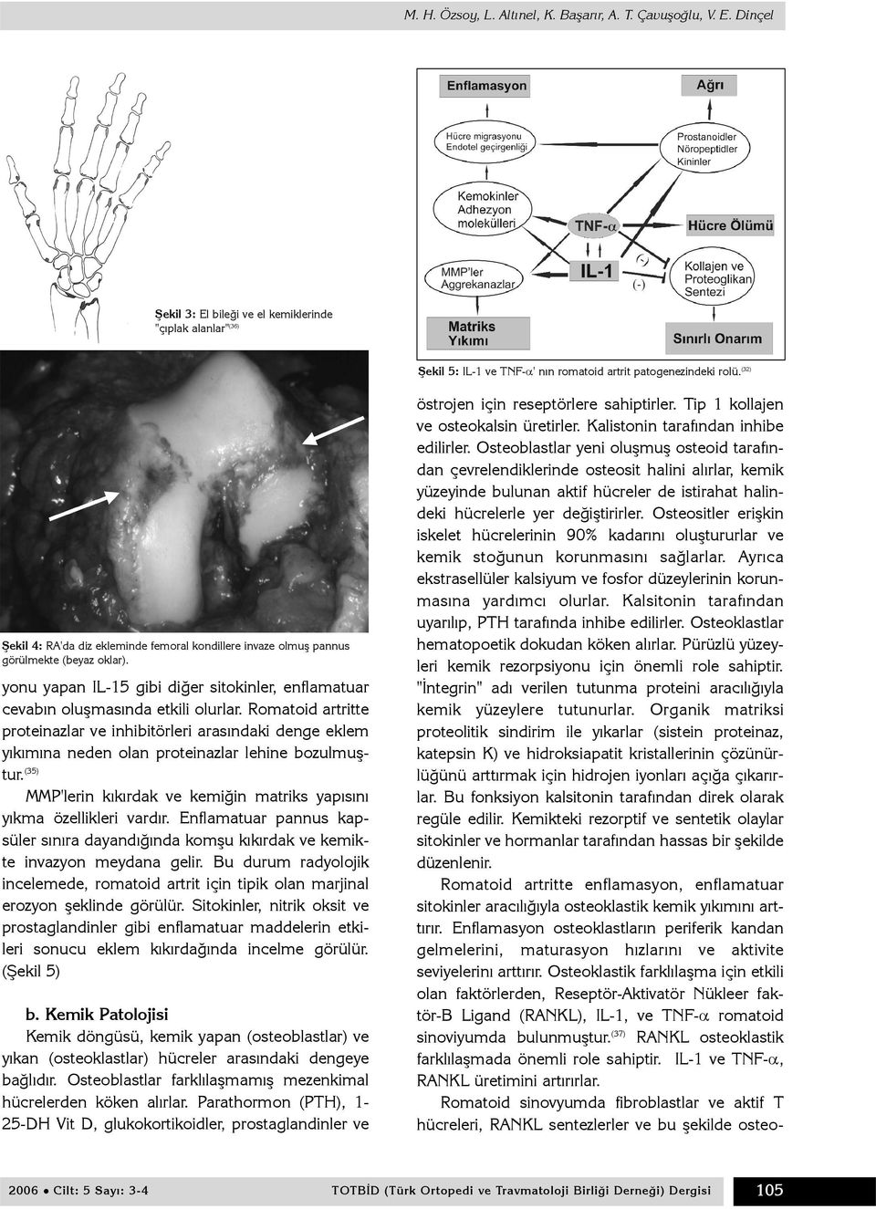 Romatoid artritte proteinazlar ve inhibitörleri arasýndaki denge eklem yýkýmýna neden olan proteinazlar lehine bozulmuþtur.