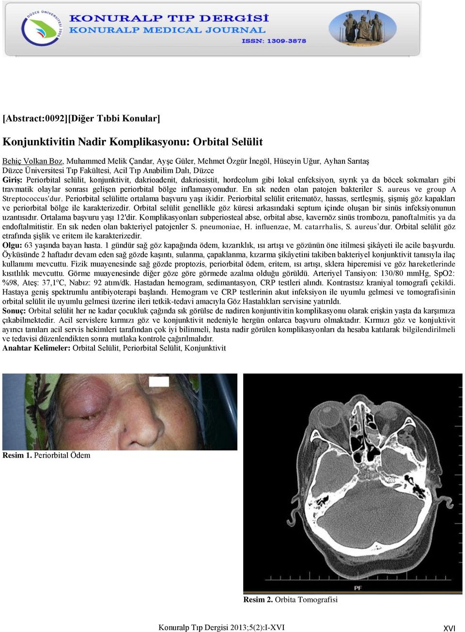 travmatik olaylar sonrası gelişen periorbital bölge inflamasyonudur. En sık neden olan patojen bakteriler S. aureus ve group A Streptococcus'dur. Periorbital selülitte ortalama başvuru yaşı ikidir.