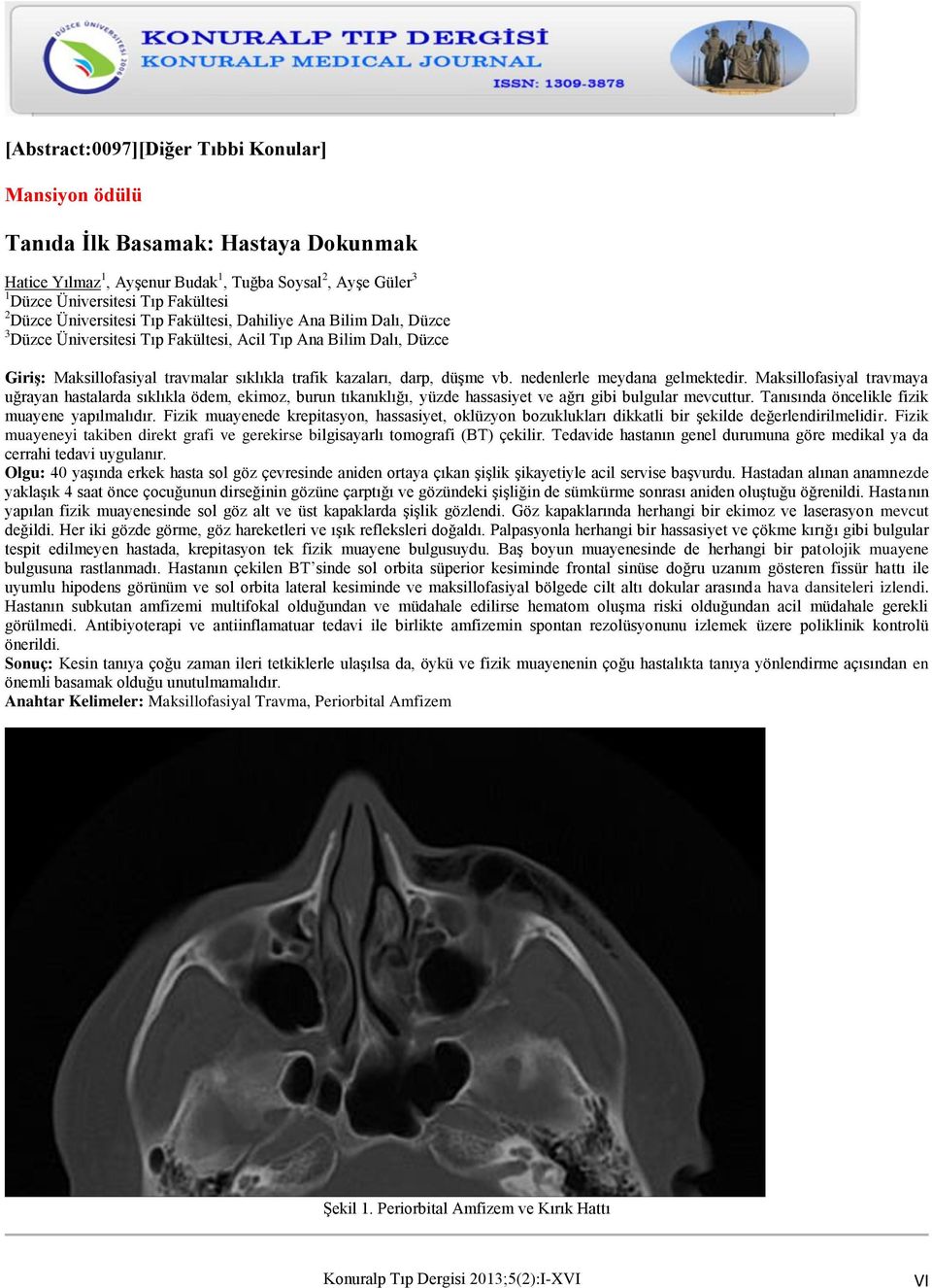 nedenlerle meydana gelmektedir. Maksillofasiyal travmaya uğrayan hastalarda sıklıkla ödem, ekimoz, burun tıkanıklığı, yüzde hassasiyet ve ağrı gibi bulgular mevcuttur.