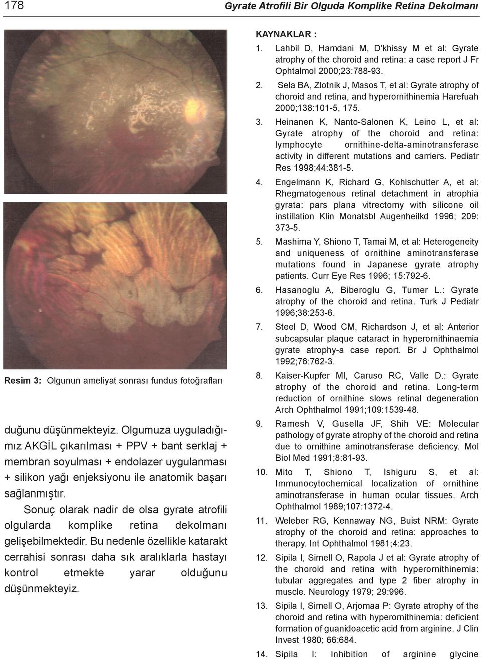 Sonuç olarak nadir de olsa gyrate atrofili olgularda komplike retina dekolmaný geliþebilmektedir.