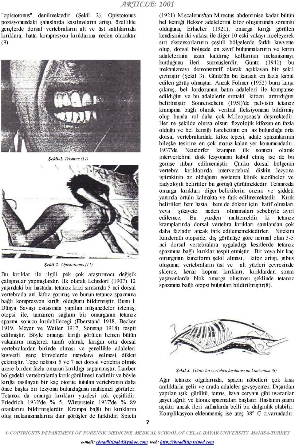 Trismus () Şekil. Opistotonus () Bu kırıklar ile ilgili pek çok araştırmacı değişik çalışmalar yapmışlardır.