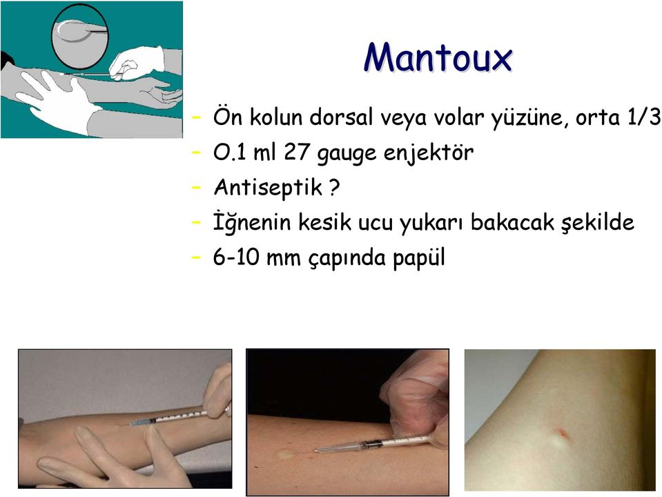 1 ml 27 gauge enjektör Antiseptik?