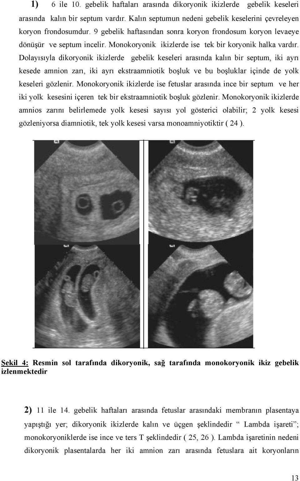 Dolayısıyla dikoryonik ikizlerde gebelik keseleri arasında kalın bir septum, iki ayrı kesede amnion zarı, iki ayrı ekstraamniotik boşluk ve bu boşluklar içinde de yolk keseleri gözlenir.