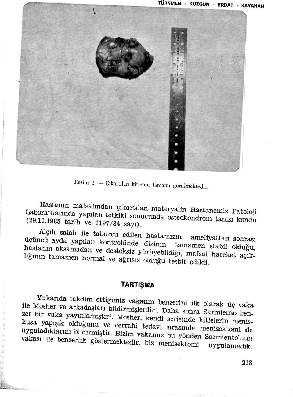 Alçılı salah ile taburcu edilen hastamızın ameliyattan sonrası üçüncü ayda yapılan kontrolünde, dizinin tamamen stabil olduğu, hastanın aksamadan ve des.